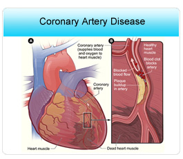 Avoid Coronary Artery Disease, Ejection Fraction